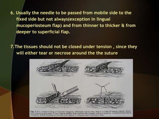6. Usually the needle to be passed from mobile side to the
fixed side but not always(exception in lingual
mucoperiosteum flap) and from thinner to thicker & from
deeper to superficial flap.
7.The tissues should not be closed under tension , since they
will either tear or necrose around the the suture
 