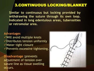 3.CONTINUOUS LOCKING/BLANKET
Similar to continuous but locking provided by
withdrawing the suture through its own loop.
Indicated in long edentulous areas, tuberosities
or retromolar area.
Advantages
Will avoid multiple knots
Distributes tension uniformly
Water tight closure
Prevents excessive tightening.
Disadvantage :prevents
adjustment of tension over
suture line as tissue swelling
occurs.
 