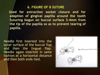 6. FIGURE OF 8 SUTURE
Used for extraction socket closure and for
adaption of gingival papilla around the tooth
Suturing begun on buccal surface 3-4mm from
the tip of the papilla so as to prevent tearing of
papilla.
Needle first inserted into the
outer surface of the buccal flap
and then the lingual flap.
Needle again inserted in same
fashion at a horizontal distance
and then both ends tied.
 