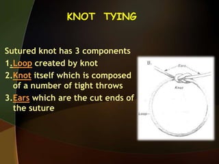 KNOT TYING
Sutured knot has 3 components
1.Loop created by knot
2.Knot itself which is composed
of a number of tight throws
3.Ears which are the cut ends of
the suture
 