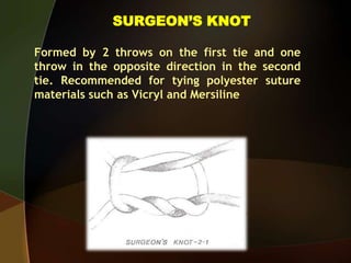 SURGEON’S KNOT
Formed by 2 throws on the first tie and one
throw in the opposite direction in the second
tie. Recommended for tying polyester suture
materials such as Vicryl and Mersiline
 