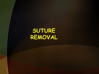 SUTURE
REMOVAL
 