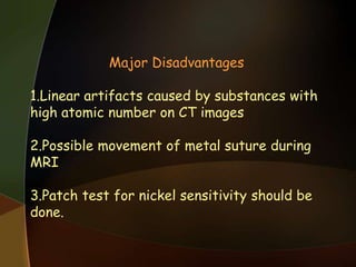 Major Disadvantages
1.Linear artifacts caused by substances with
high atomic number on CT images
2.Possible movement of metal suture during
MRI
3.Patch test for nickel sensitivity should be
done.
 