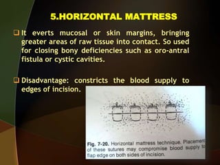 5.HORIZONTAL MATTRESS
 It everts mucosal or skin margins, bringing
greater areas of raw tissue into contact. So used
for closing bony deficiencies such as oro-antral
fistula or cystic cavities.
 Disadvantage: constricts the blood supply to
edges of incision.
 