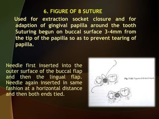 6. FIGURE OF 8 SUTURE
Used for extraction socket closure and for
adaption of gingival papilla around the tooth
Suturing begun on buccal surface 3-4mm from
the tip of the papilla so as to prevent tearing of
papilla.
Needle first inserted into the
outer surface of the buccal flap
and then the lingual flap.
Needle again inserted in same
fashion at a horizontal distance
and then both ends tied.
 