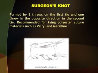 SURGEON’S KNOT
Formed by 2 throws on the first tie and one
throw in the opposite direction in the second
tie. Recommended for tying polyester suture
materials such as Vicryl and Mersiline
 