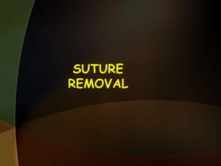 SUTURE
REMOVAL
 