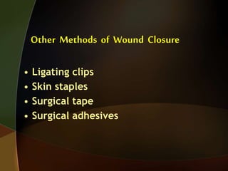 Other Methods of Wound Closure
• Ligating clips
• Skin staples
• Surgical tape
• Surgical adhesives
 