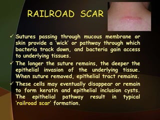 RAILROAD SCAR
 Sutures passing through mucous membrane or
skin provide a ‘wick’ or pathway through which
bacteria track down, and bacteria gain access
to underlying tissues.
 The longer the suture remains, the deeper the
epithelial invasion of the underlying tissue.
When suture removed, epithelial tract remains.
 These cells may eventually disappear or remain
to form keratin and epithelial inclusion cysts.
The epithelial pathway result in typical
‘railroad scar’ formation.
 