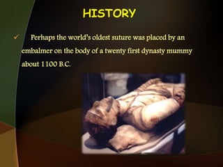 HISTORY
 Perhaps the world’s oldest suture was placed by an
embalmer on the body of a twenty first dynasty mummy
about 1100 B.C.
 