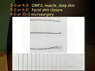 3-0 or 4-0 OMFS, muscle, deep skin
5-0 or 6-0 facial skin closure
9-0 or 10-0 microsurgery
 