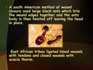 • A south American method of wound
closure used large black ants which bite
the wound edges together and the ants
body is then twisted off leaving the head
in place.
• East African tribes ligated blood vessels
with tendons and closed wounds with
acacia thorns.
 