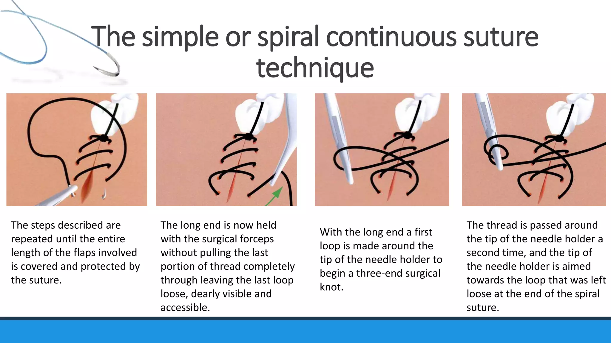 Suture Material Suturing Technique Ppt Suture Material Suturing Technique Ppt
