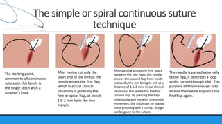 Suture material & suturing technique | PPTX