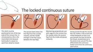 Suture material & suturing technique | PPTX