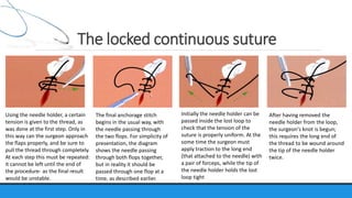 Suture material & suturing technique | PPTX