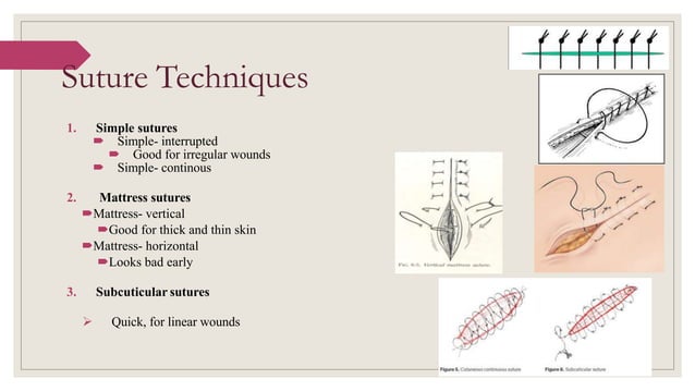 Suture, needle and knots | PPTX