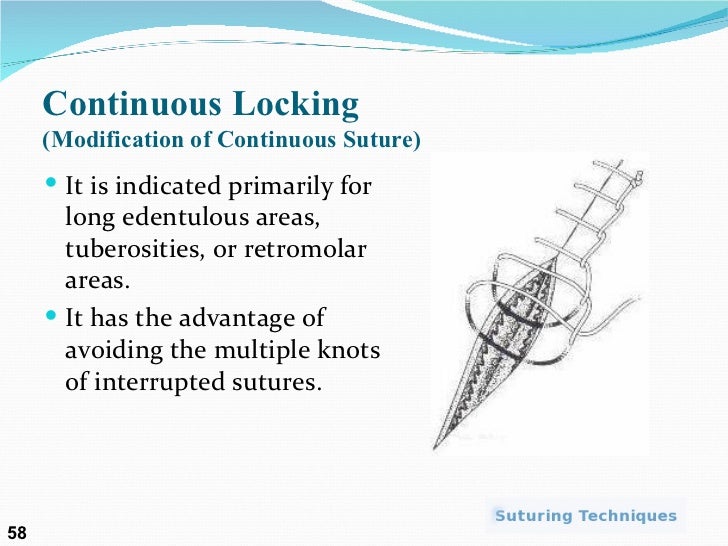 Suture presentation by Dr. Nabeel ur Rehman and Dr. Suneel Maghnani