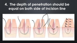 sutures and instruments handling seminar | PDF