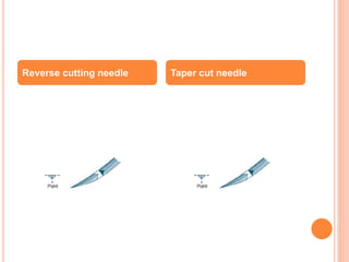 Reverse cutting needle Taper cut needle
 