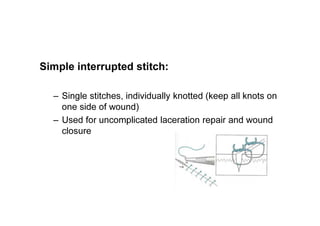 Simple interrupted stitch:
– Single stitches, individually knotted (keep all knots on
one side of wound)
– Used for uncomplicated laceration repair and wound
closure
 