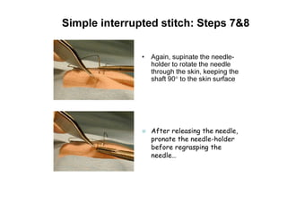 Simple interrupted stitch: Steps 7&8
• Again, supinate the needle-
holder to rotate the needle
through the skin, keeping the
shaft 90° to the skin surface
After releasing the needle,
pronate the needle-holder
before regrasping the
needle…
 
