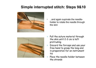 Simple interrupted stitch: Steps 9&10
• …and again supinate the needle-
holder to rotate the needle through
the skin
Pull the suture material through
the skin until 2-3 cm is left
protruding
Discard the forceps and use your
free hand to grasp the long end
in preparation for an instrument
tie
Place the needle-holder between
the strands
 