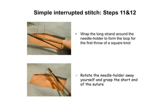 Simple interrupted stitch: Steps 11&12
• Wrap the long strand around the
needle-holder to form the loop for
the first throw of a square knot
Rotate the needle-holder away
yourself and grasp the short end
of the suture
 