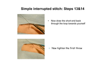 Simple interrupted stitch: Steps 13&14
• Now draw the short end back
through the loop towards yourself
Now tighten the first throw
 