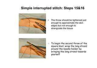Simple interrupted stitch: Steps 15&16
• The throw should be tightened just
enough to approximate the skin
edges but not enough to
strangulate the tissue
To begin the second throw of the
square knot, wrap the long strand
around the needle-holder by
bringing the long strand towards
yourself
 