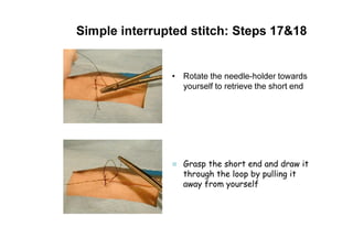 Simple interrupted stitch: Steps 17&18
• Rotate the needle-holder towards
yourself to retrieve the short end
Grasp the short end and draw it
through the loop by pulling it
away from yourself
 
