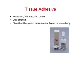 Tissue Adhesive
• Nexaband, Vetbond, and others
• Little strength
• Should not be placed between skin layers or inside body
 