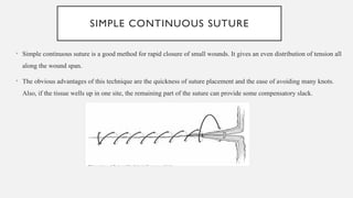 Simple Continuous Pattern Surgery Sutures and suturing techniques periodontology.pptx