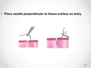 Sutures emad