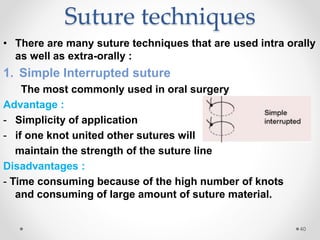 Sutures emad