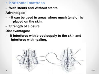 Sutures emad