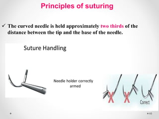 Sutures emad