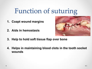 Sutures emad