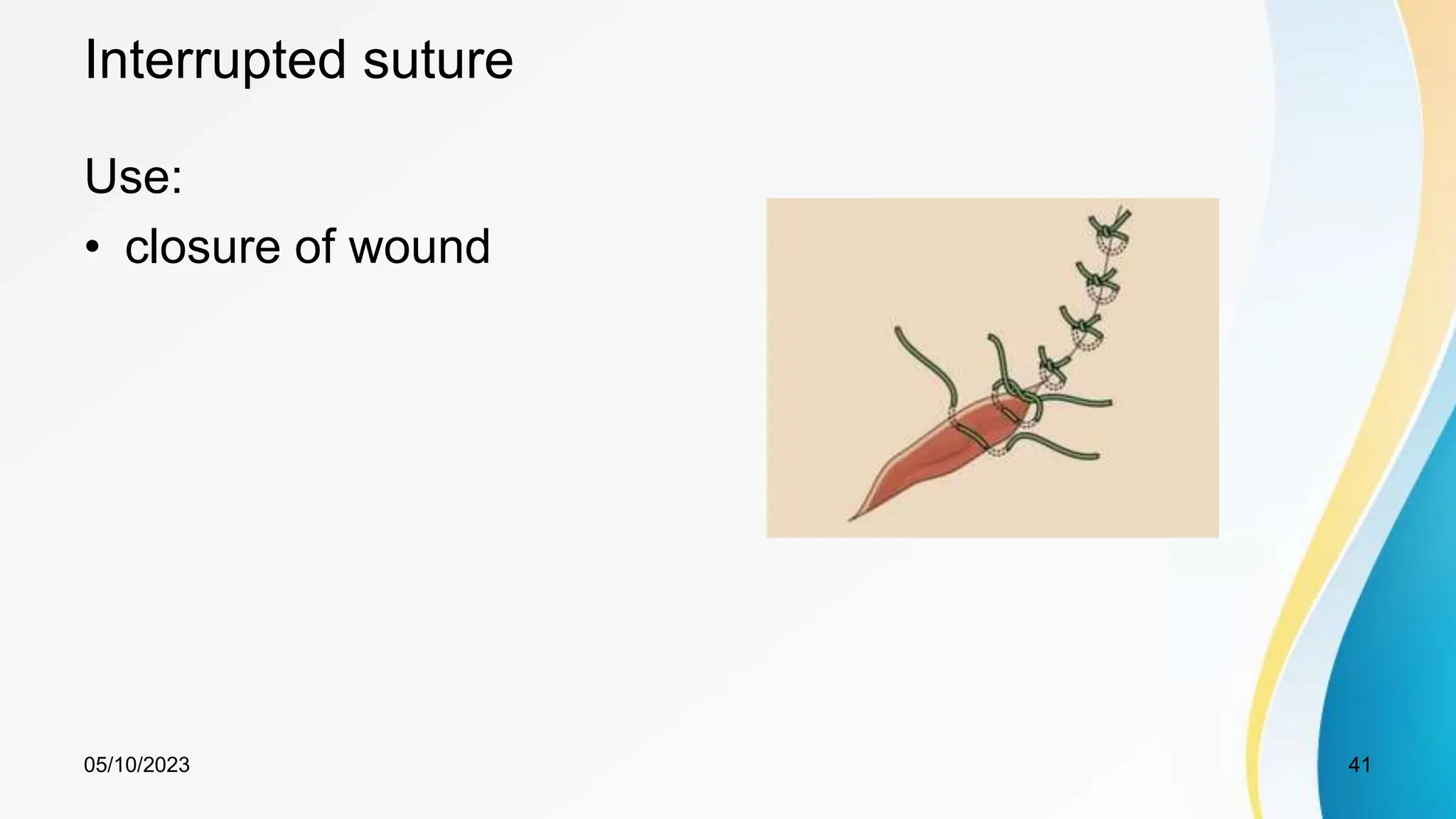Interrupted suture
Use:
• closure of wound
05/10/2023 41
 