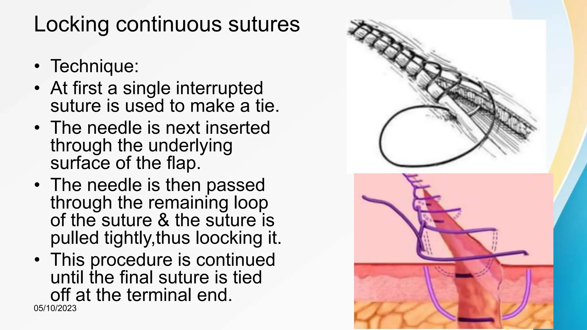 Locking continuous sutures
• Technique:
• At first a single interrupted
suture is used to make a tie.
• The needle is next inserted
through the underlying
surface of the flap.
• The needle is then passed
through the remaining loop
of the suture & the suture is
pulled tightly,thus loocking it.
• This procedure is continued
until the final suture is tied
off at the terminal end.
05/10/2023 48
 
