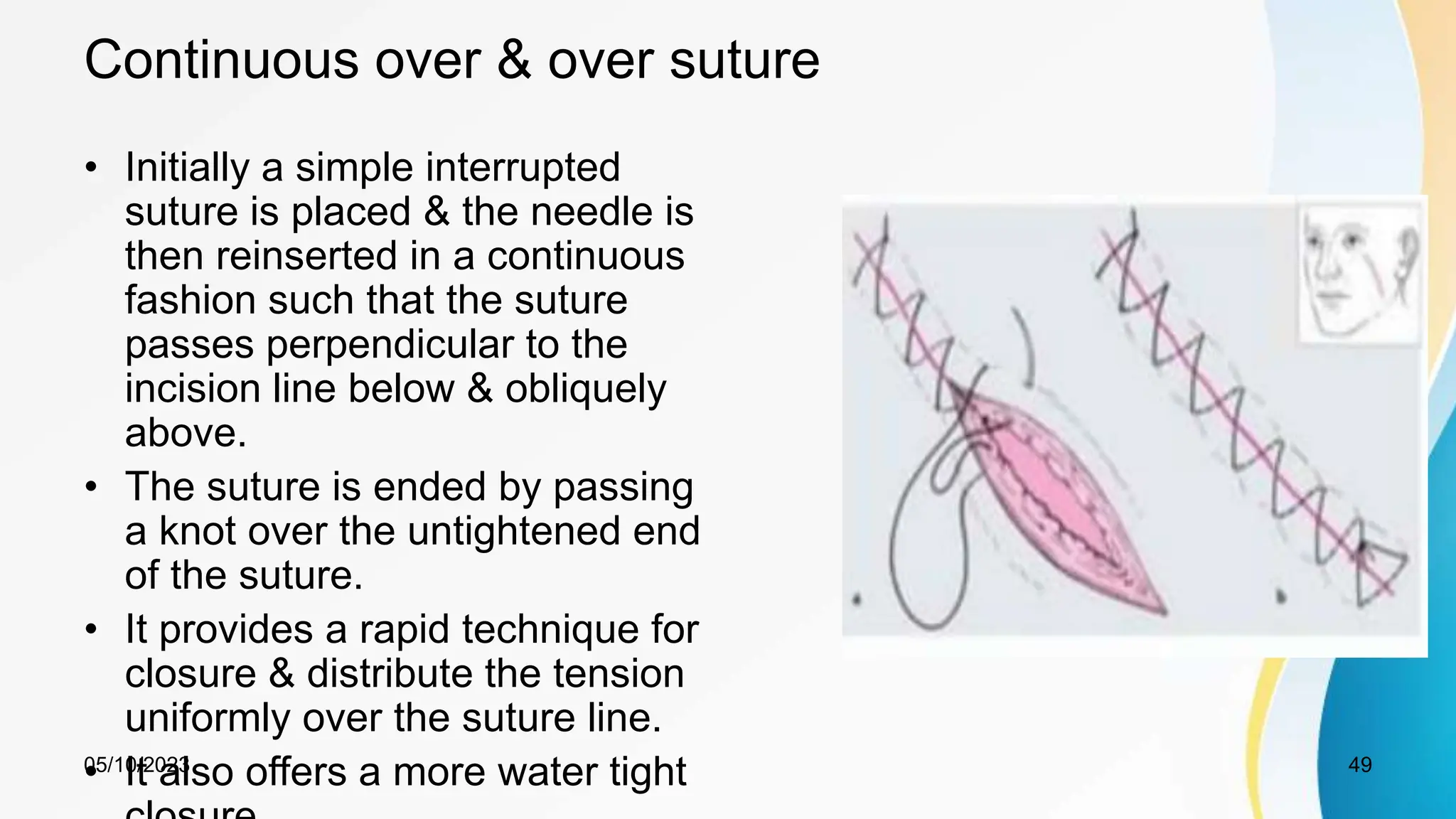 Continuous over & over suture
• Initially a simple interrupted
suture is placed & the needle is
then reinserted in a continuous
fashion such that the suture
passes perpendicular to the
incision line below & obliquely
above.
• The suture is ended by passing
a knot over the untightened end
of the suture.
• It provides a rapid technique for
closure & distribute the tension
uniformly over the suture line.
• It also offers a more water tight
05/10/2023 49
 