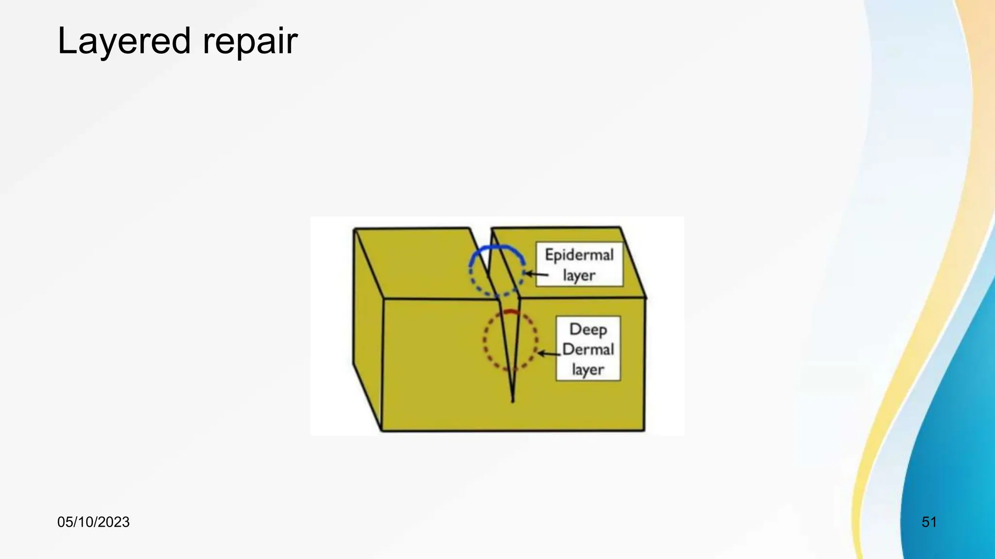 Layered repair
05/10/2023 51
 