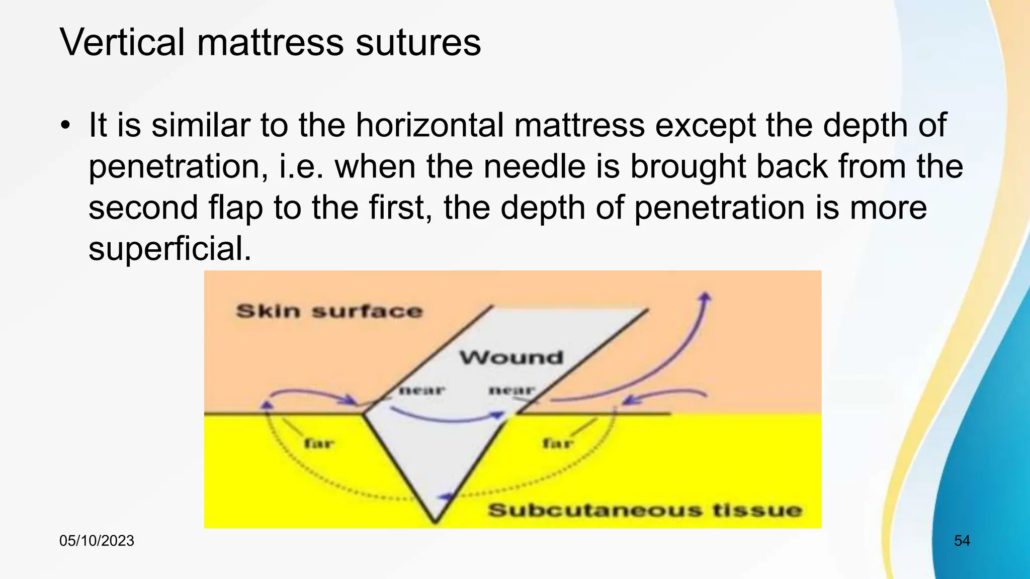 Vertical mattress sutures
• It is similar to the horizontal mattress except the depth of
penetration, i.e. when the needle is brought back from the
second flap to the first, the depth of penetration is more
superficial.
05/10/2023 54
 