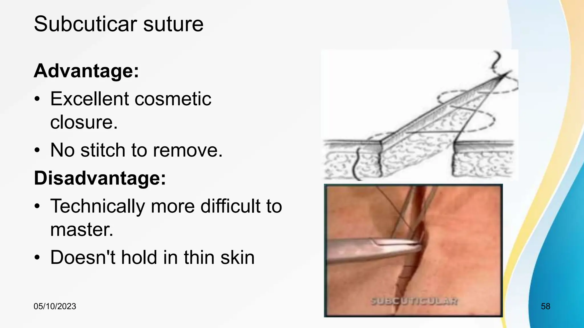 Subcuticar suture
Advantage:
• Excellent cosmetic
closure.
• No stitch to remove.
Disadvantage:
• Technically more difficult to
master.
• Doesn't hold in thin skin
05/10/2023 58
 