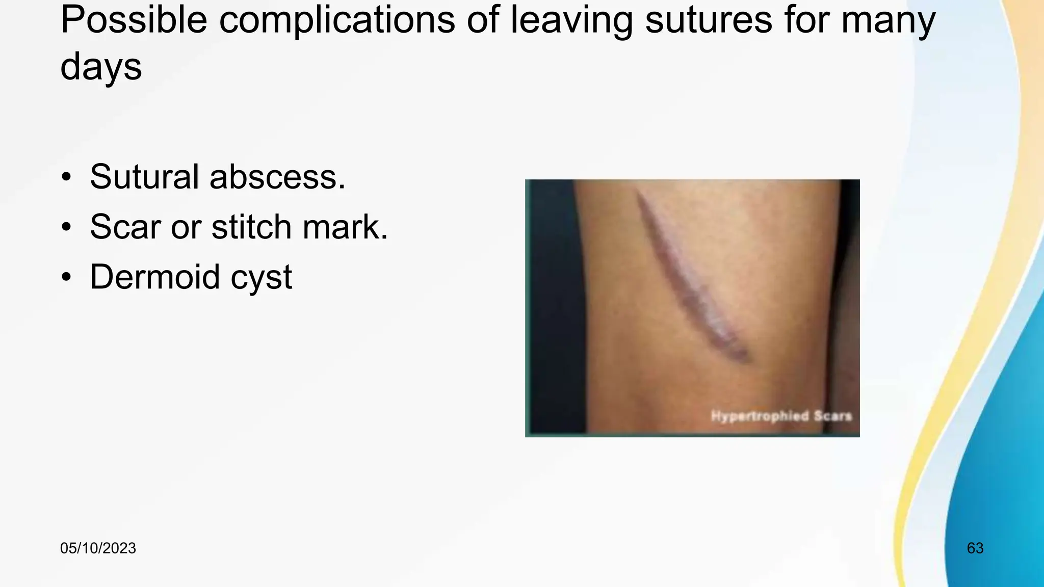 Possible complications of leaving sutures for many
days
• Sutural abscess.
• Scar or stitch mark.
• Dermoid cyst
05/10/2023 63
 