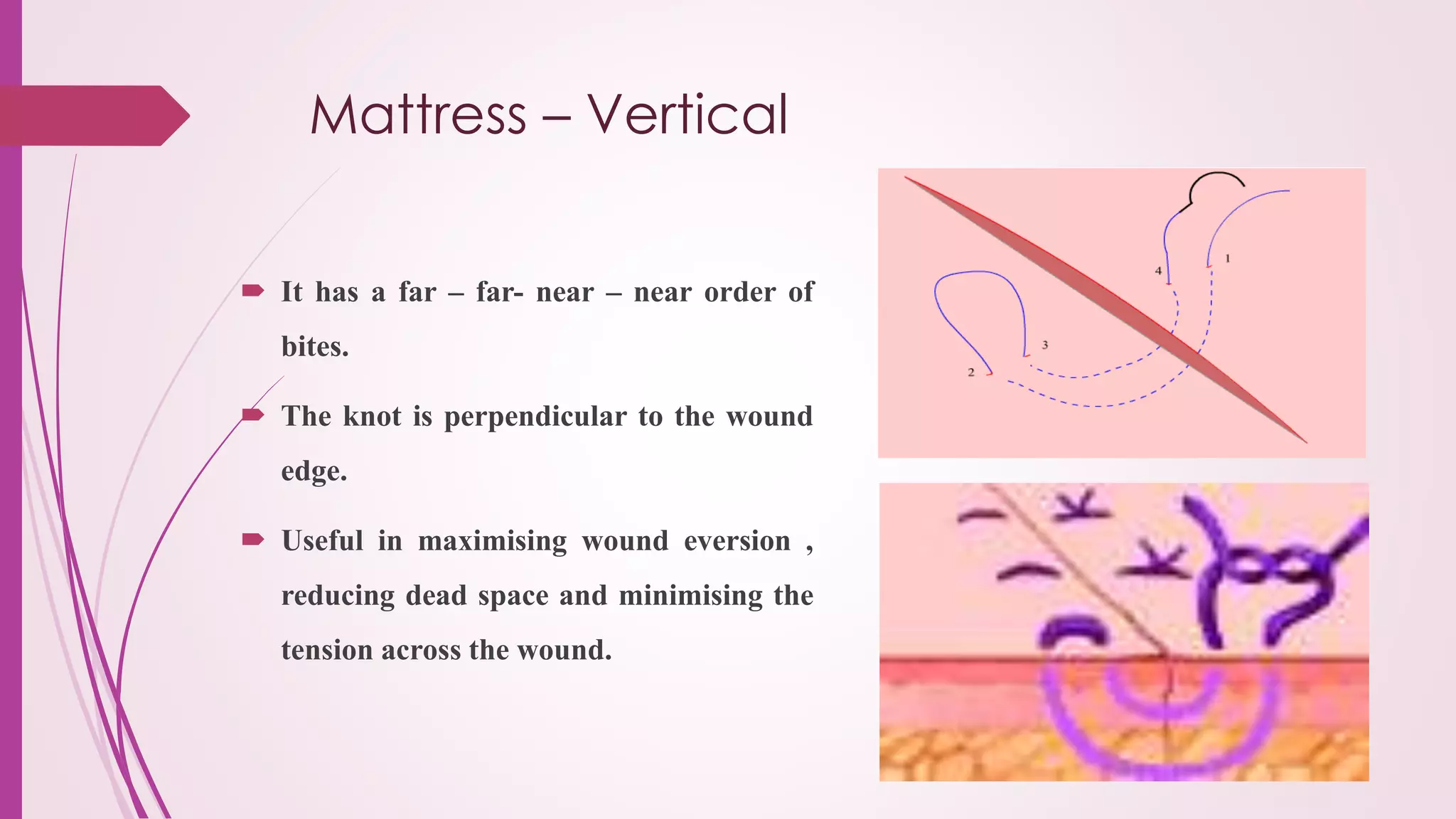 Sutures / Needles & Knots | PPTX