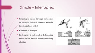 Simple – Interrupted
 Suturing is passed through both edges
at an equal depth & distance from the
incision & knot is tied.
 Common & Stronger.
 Each suture is independent & loosening
of one suture will not produce loosening
of other.
 