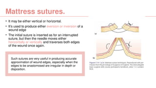 Sutures surgery seminar.pptx from bailey | PPTX