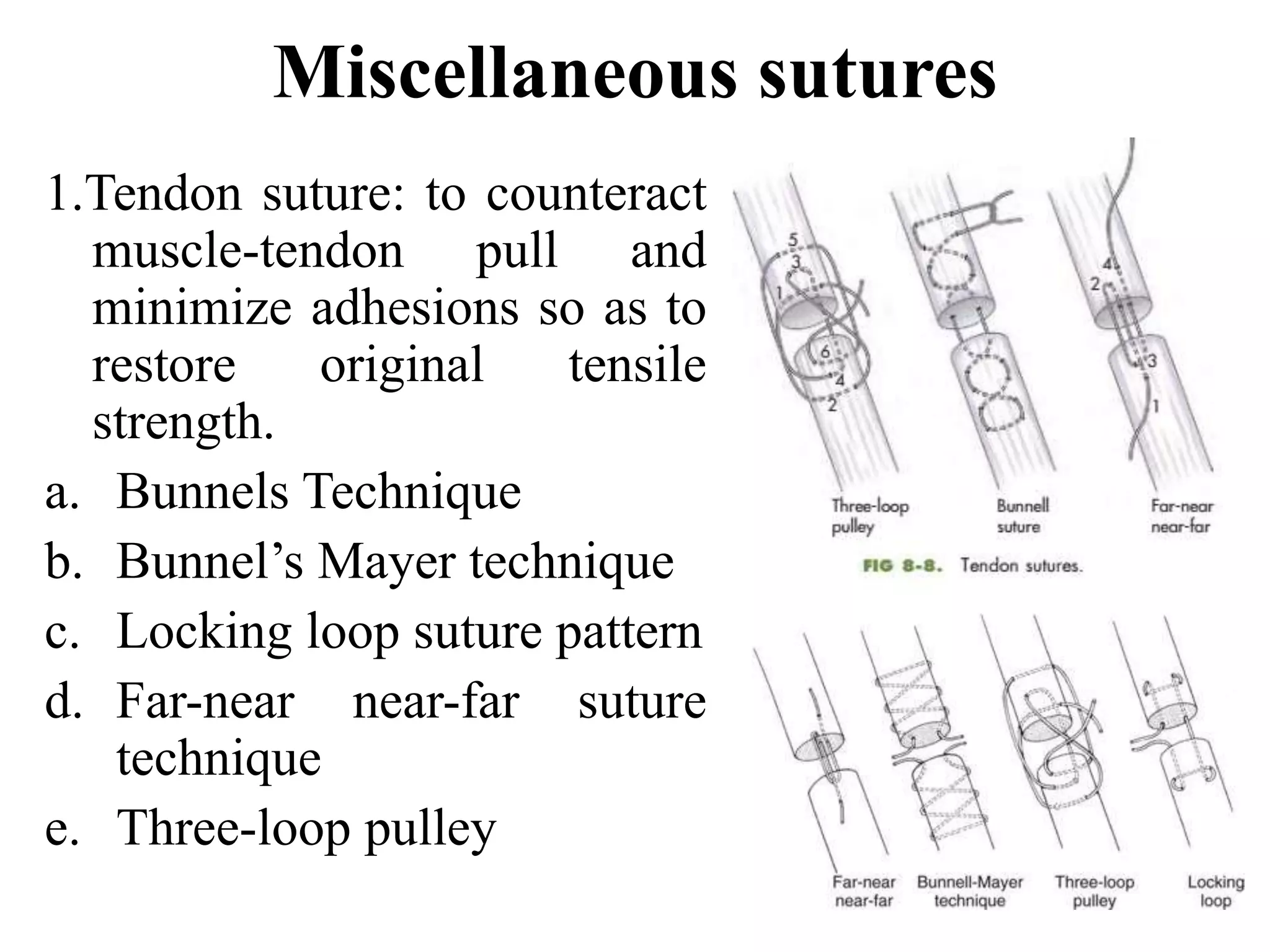 Miscellaneous sutures
1.Tendon suture: to counteract
muscle-tendon pull and
minimize adhesions so as to
restore original tensile
strength.
a. Bunnels Technique
b. Bunnel’s Mayer technique
c. Locking loop suture pattern
d. Far-near near-far suture
technique
e. Three-loop pulley
 