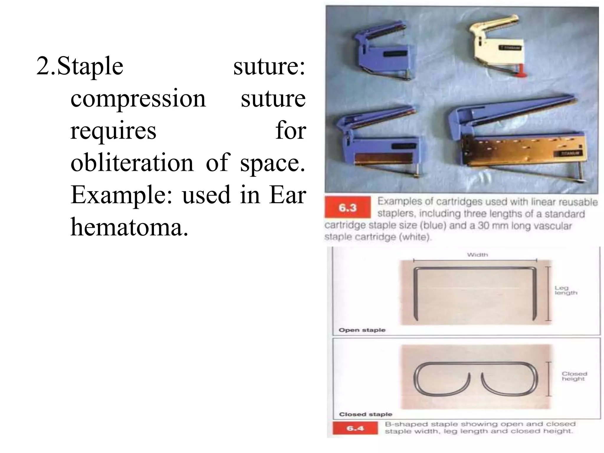 2.Staple suture:
compression suture
requires for
obliteration of space.
Example: used in Ear
hematoma.
 